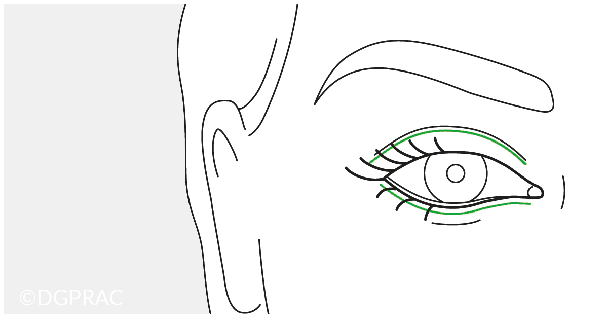 Augenlidkorrekturen und Augenlidstraffung in der Praxis FINKE & FRANTZEN Plastische Chirurgie Berlin