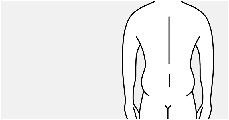Medical illustration: starting point – flank fat on the male torso, rear view